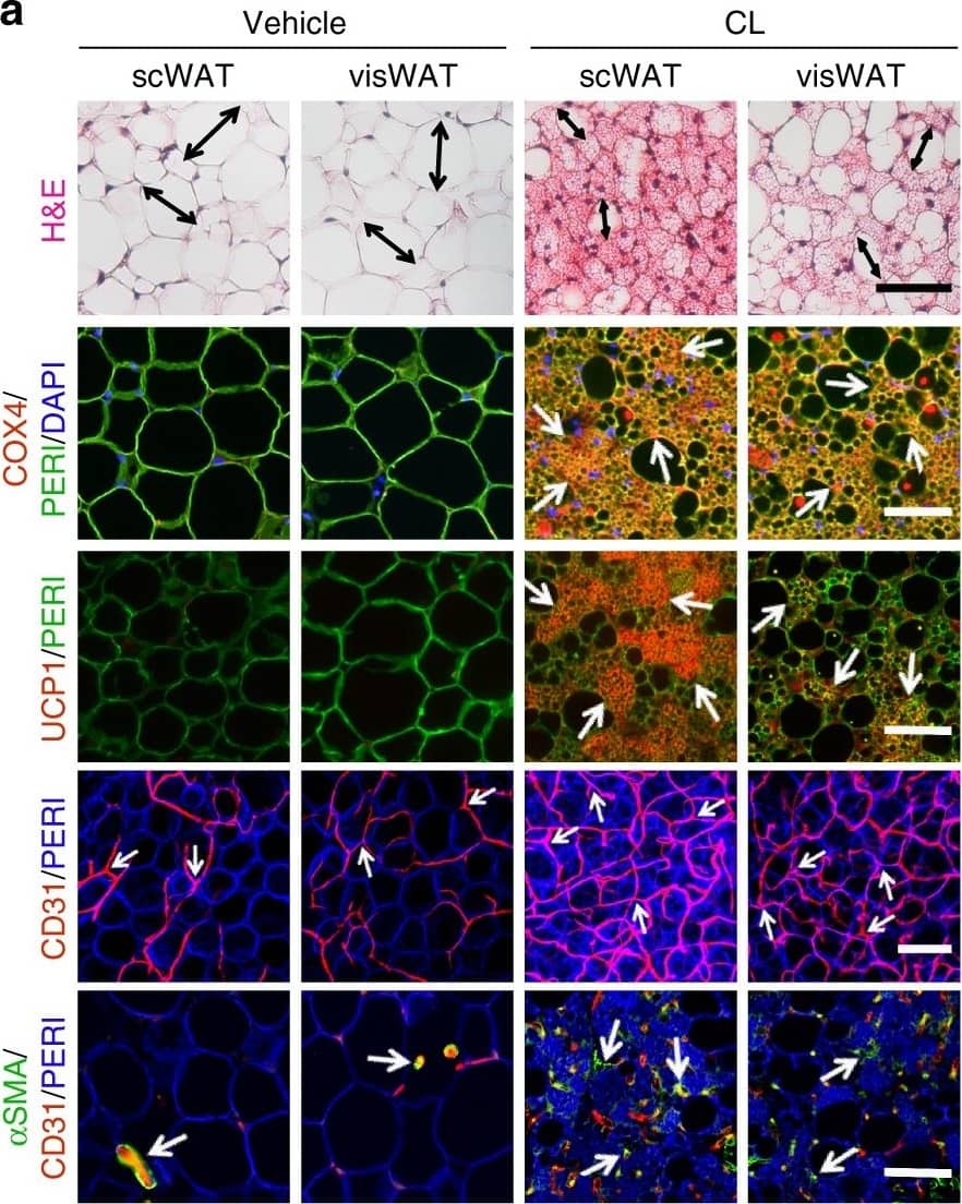 Detection of Mouse CD31/PECAM-1 by Immunocytochemistry/Immunofluorescence
