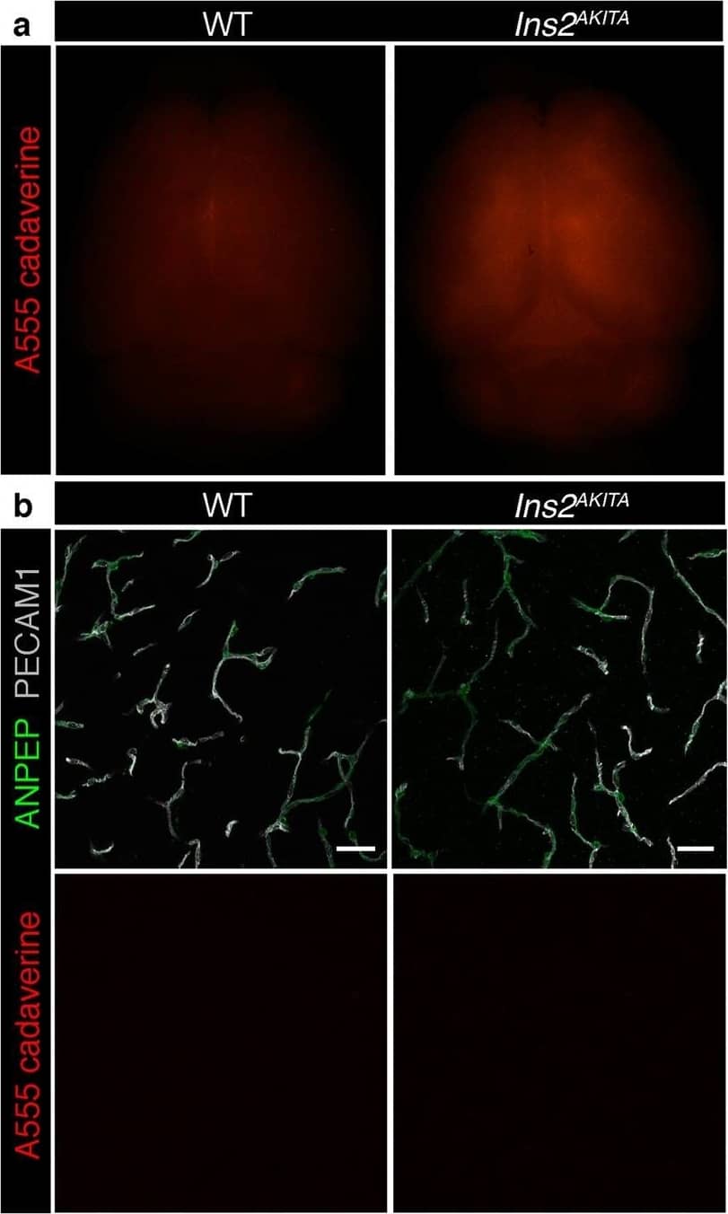 Detection of Mouse CD31/PECAM-1 by Immunohistochemistry