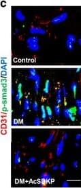 Detection of Mouse CD31/PECAM-1 by Immunocytochemistry/Immunofluorescence
