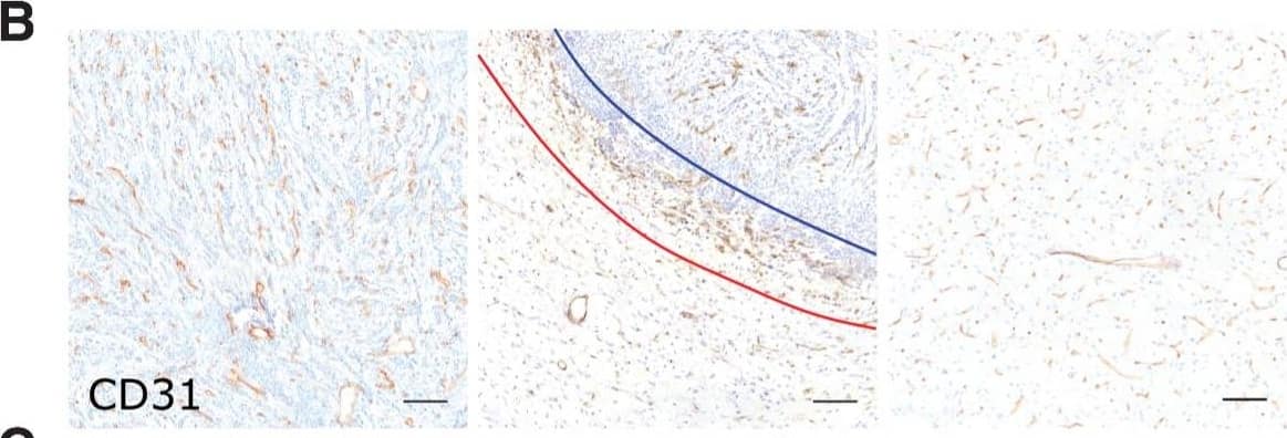 Detection of Human CD31/PECAM-1 by Immunohistochemistry