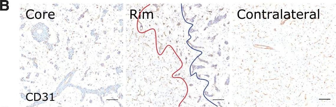 Detection of Mouse CD31/PECAM-1 by Immunohistochemistry
