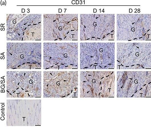 Detection of CD31/PECAM-1 by Immunohistochemistry