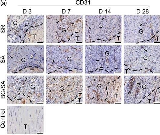 Detection of CD31/PECAM-1 by Immunohistochemistry