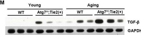 Detection of CD31/PECAM-1 by Immunohistochemistry