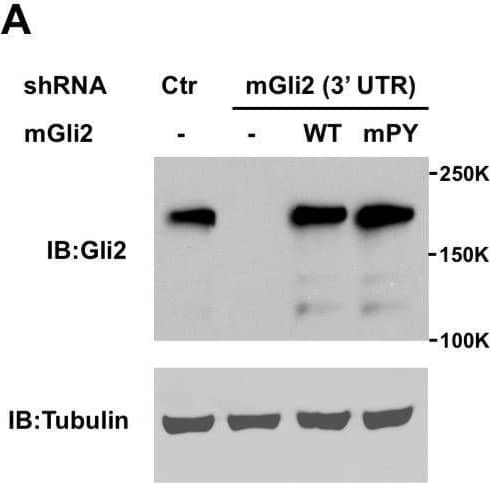 Detection of GLI-2 by Western Blot