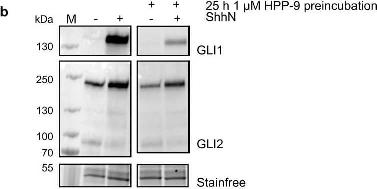 Detection of Mouse GLI-2 by Western Blot