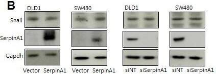 Detection of Human Snail by Western Blot