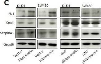 Detection of Human Snail by Western Blot