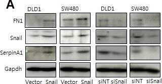 Detection of Human Snail by Western Blot