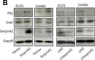 Detection of Human Snail by Western Blot
