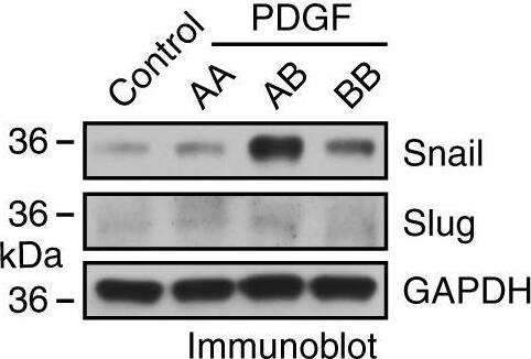 Detection of Human Snail by Western Blot