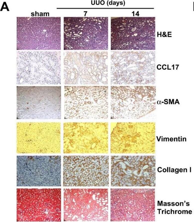 Detection of CCL17/TARC by Immunohistochemistry
