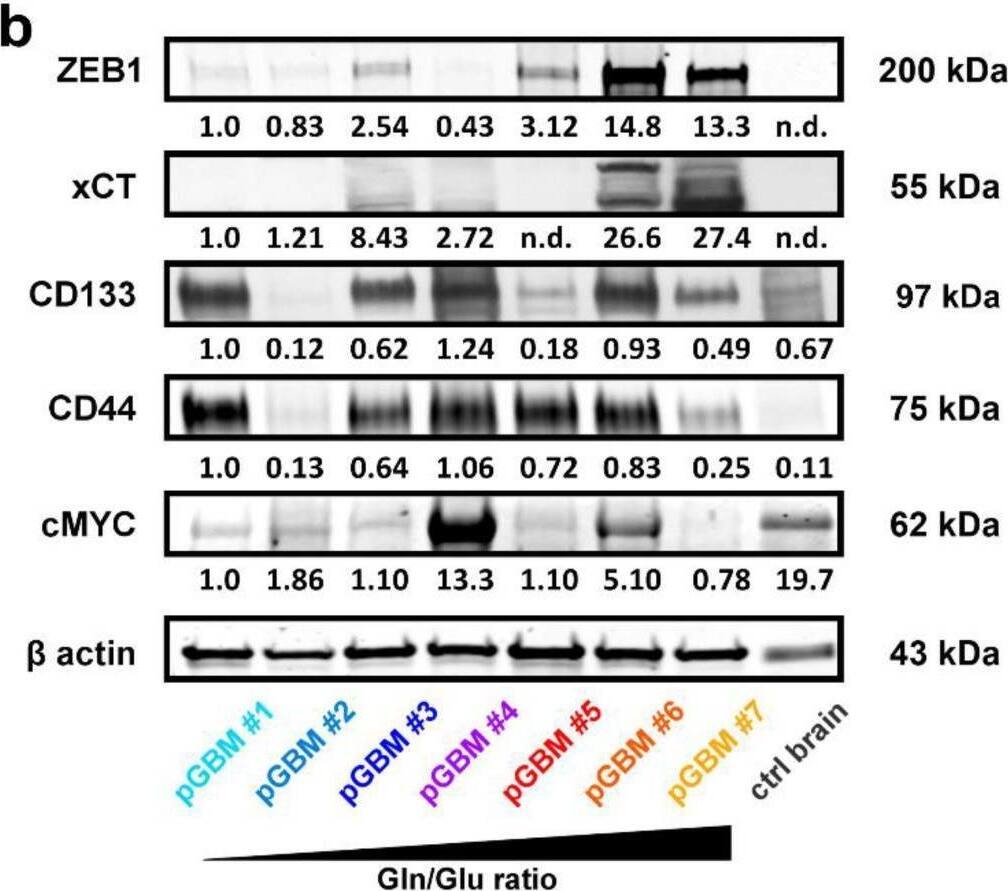 Detection of CD44 by Western Blot
