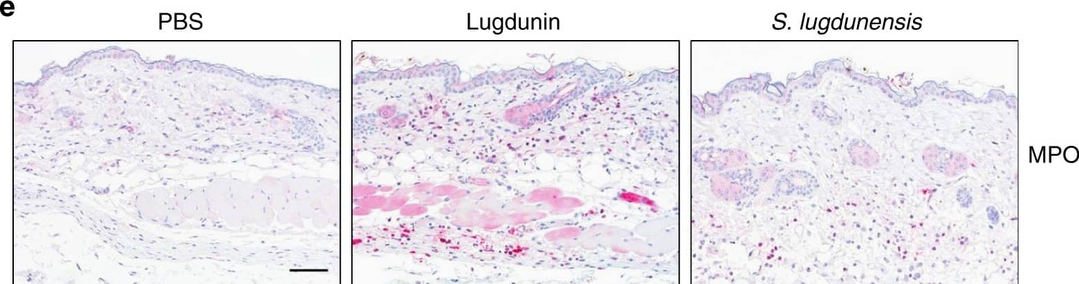 Detection of Mouse Myeloperoxidase/MPO by Immunocytochemistry/Immunofluorescence