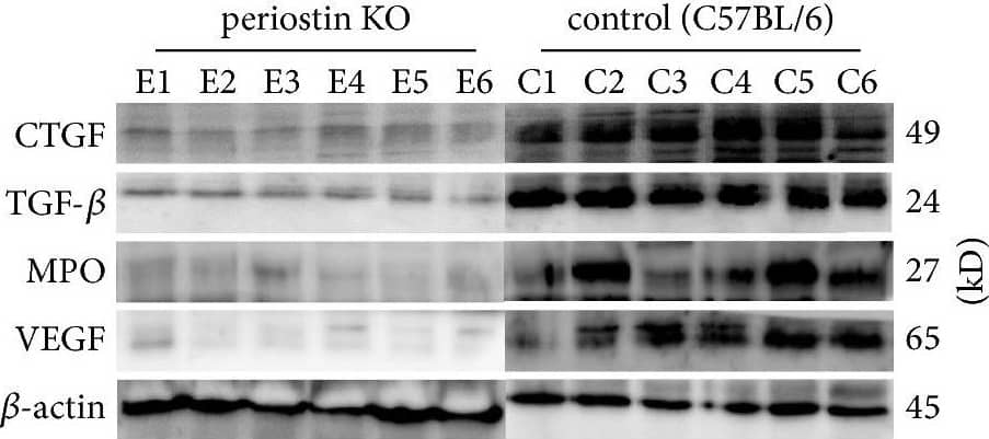 Detection of Mouse Myeloperoxidase/MPO by Western Blot