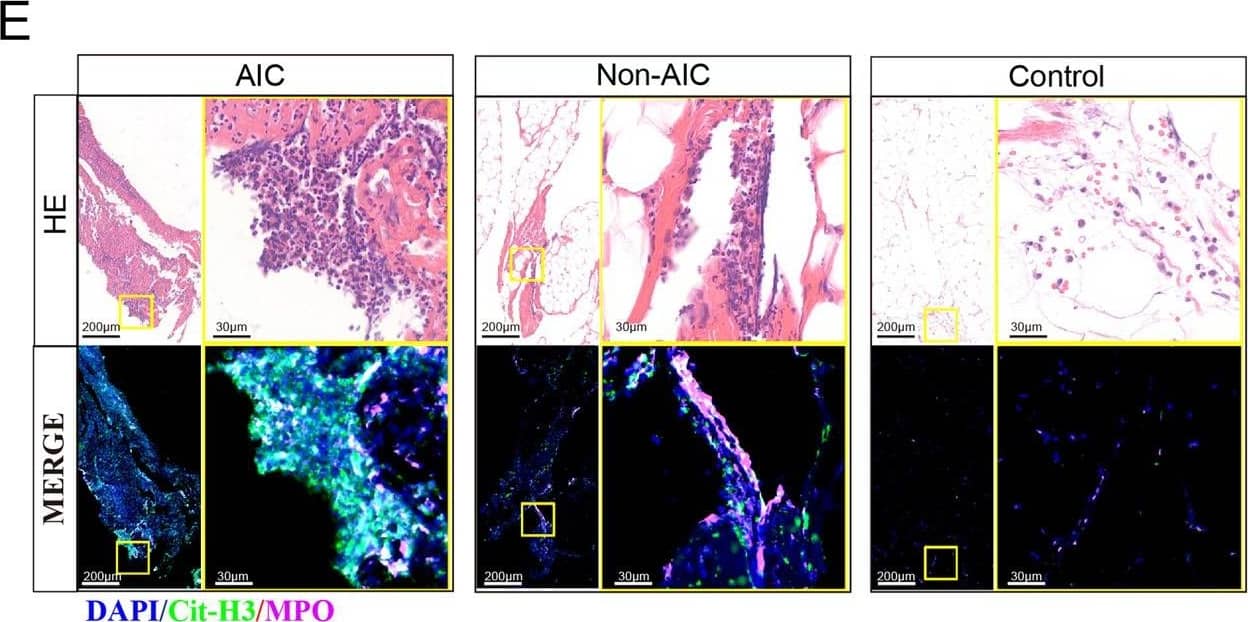 Detection of Human Myeloperoxidase/MPO by Immunohistochemistry
