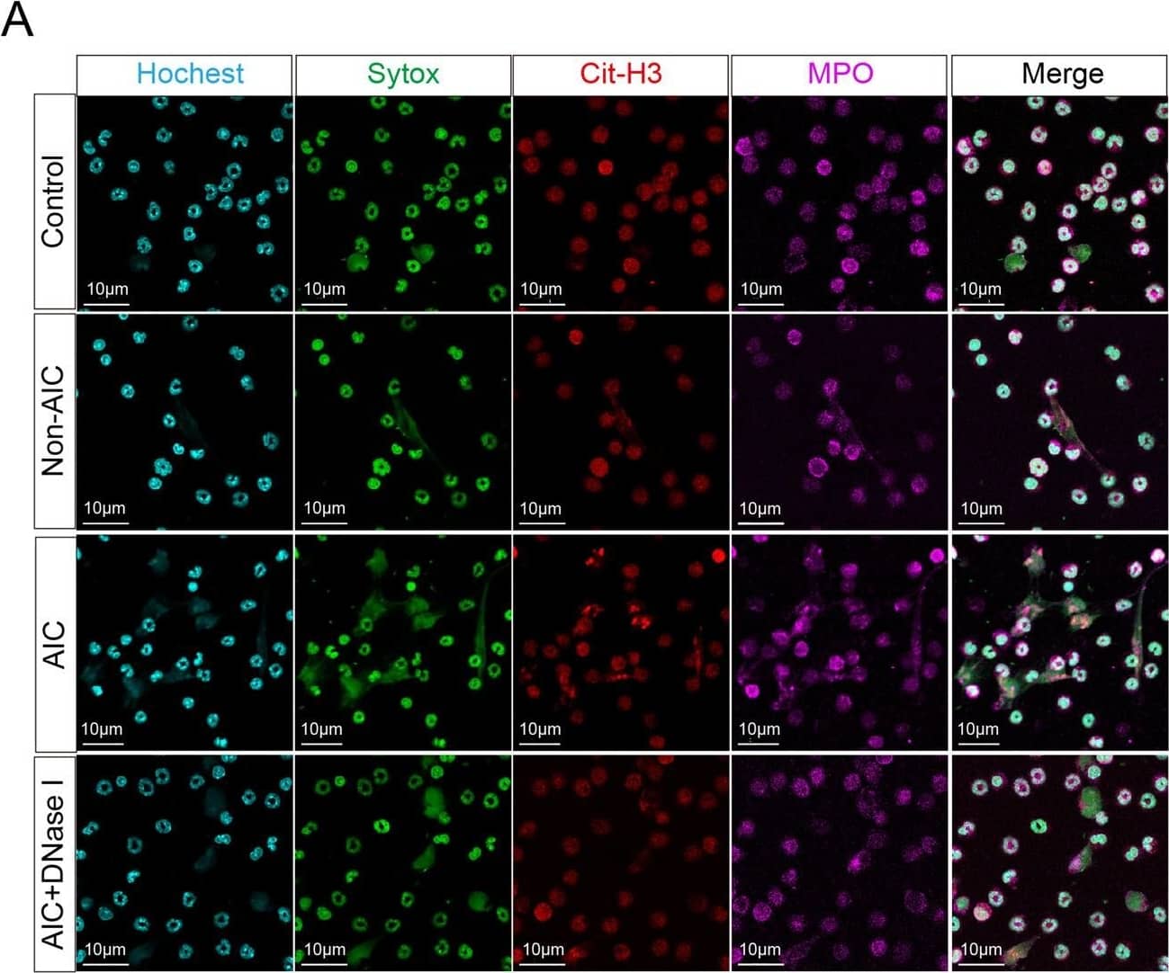 Detection of Human Myeloperoxidase/MPO by Immunohistochemistry