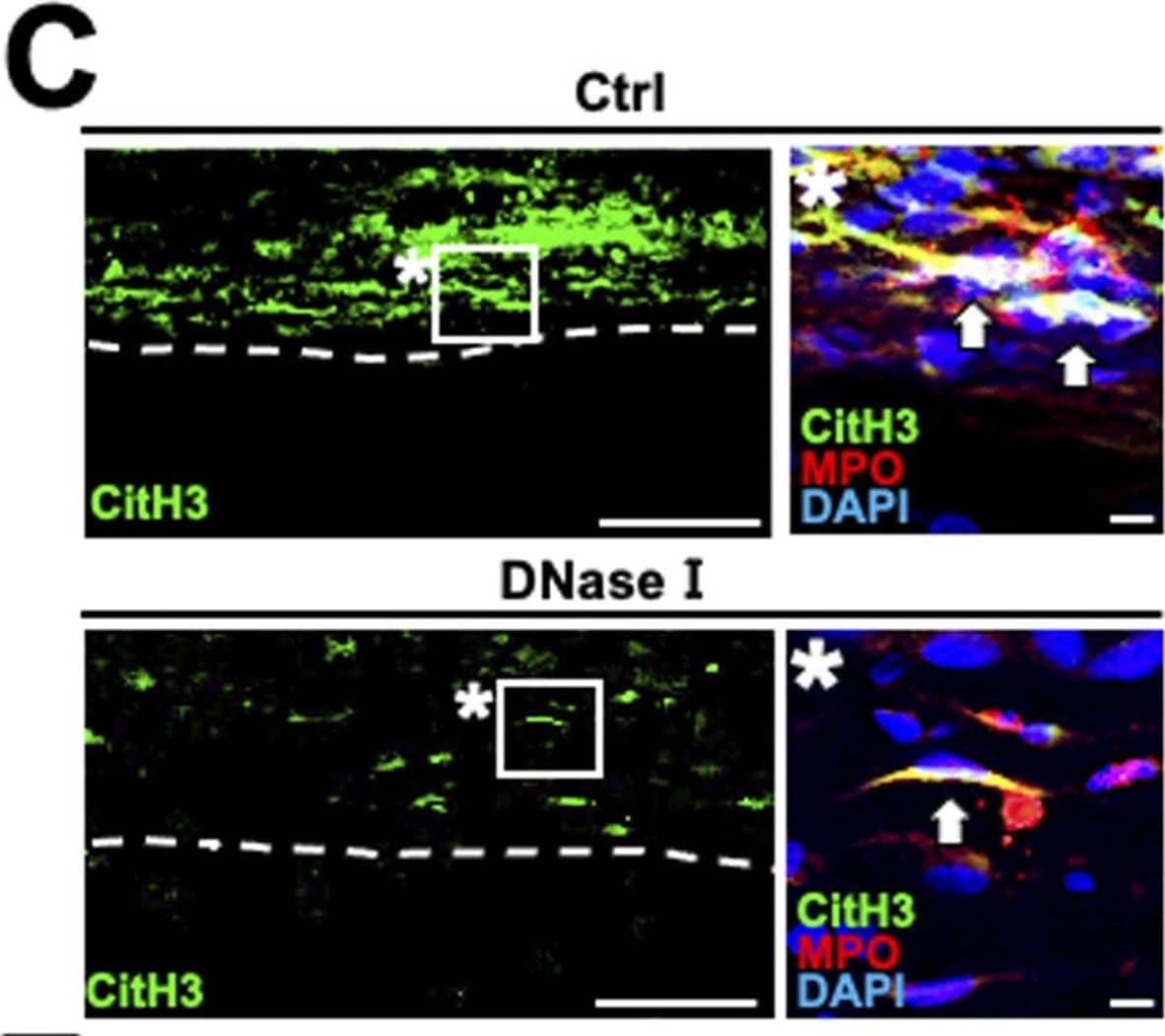 Detection of Rat Myeloperoxidase/MPO by Immunohistochemistry