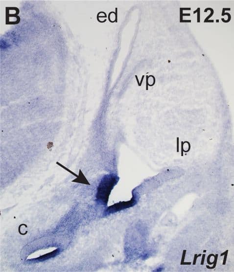 Detection of Mouse LRIG1 by Immunohistochemistry