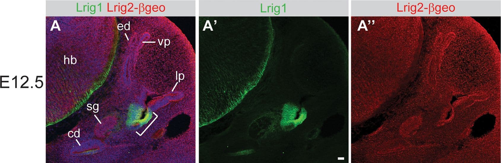 Detection of Mouse LRIG1 by Immunocytochemistry/Immunofluorescence