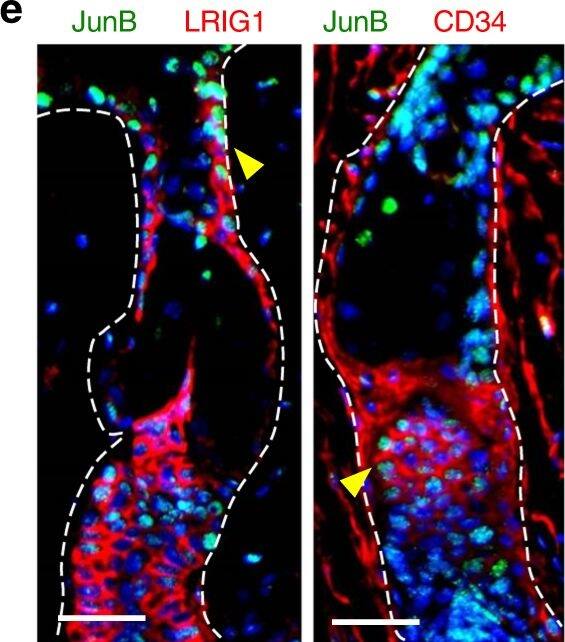 Detection of Mouse LRIG1 by Immunohistochemistry