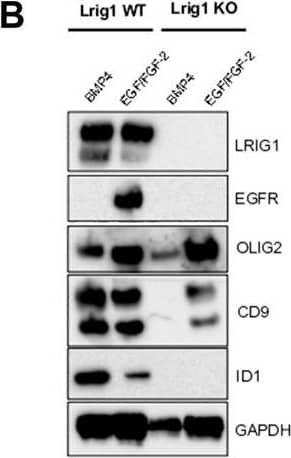 Detection of Mouse LRIG1 by Western Blot