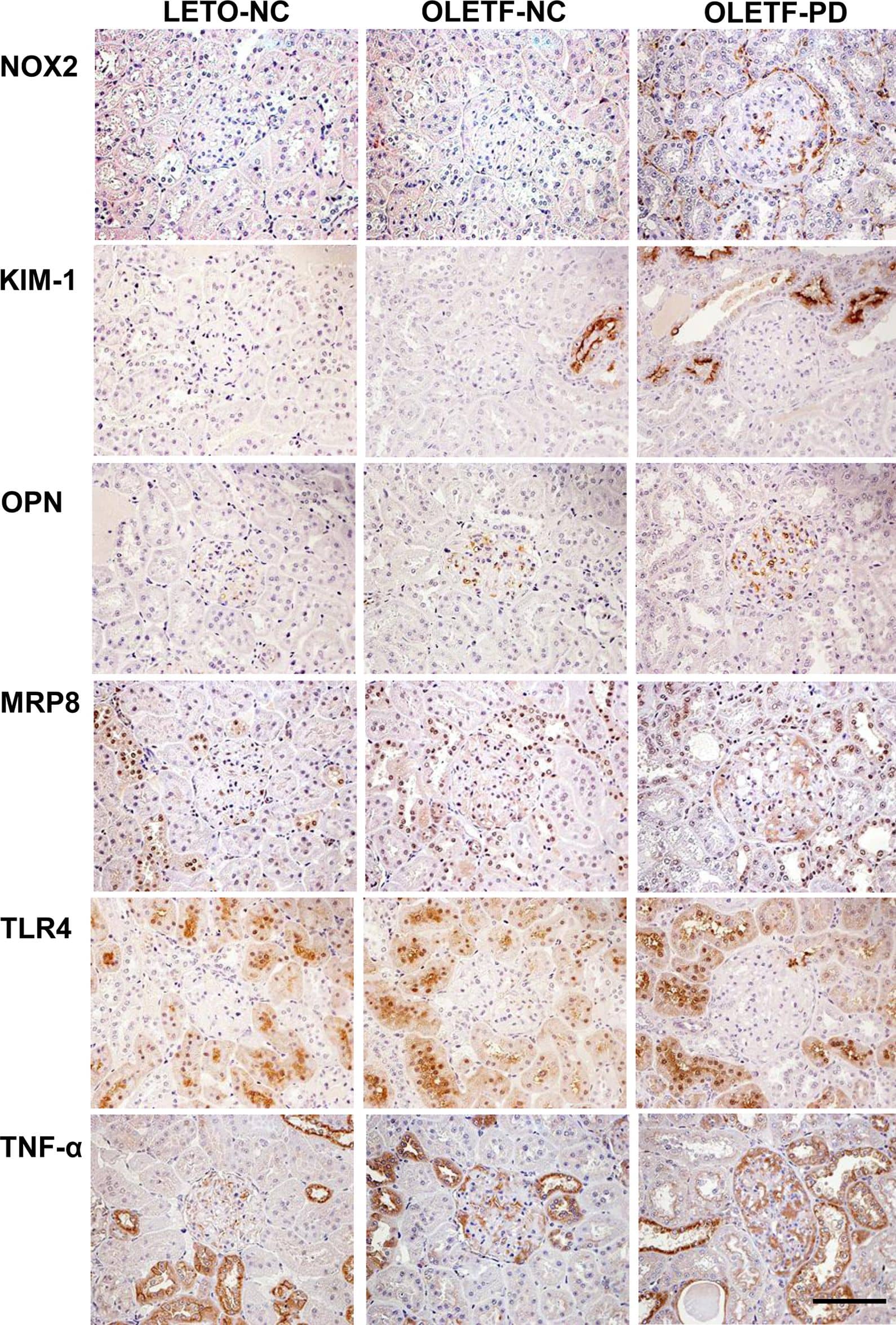 Detection of Rat TIM-1/KIM-1/HAVCR by Immunocytochemistry/Immunofluorescence