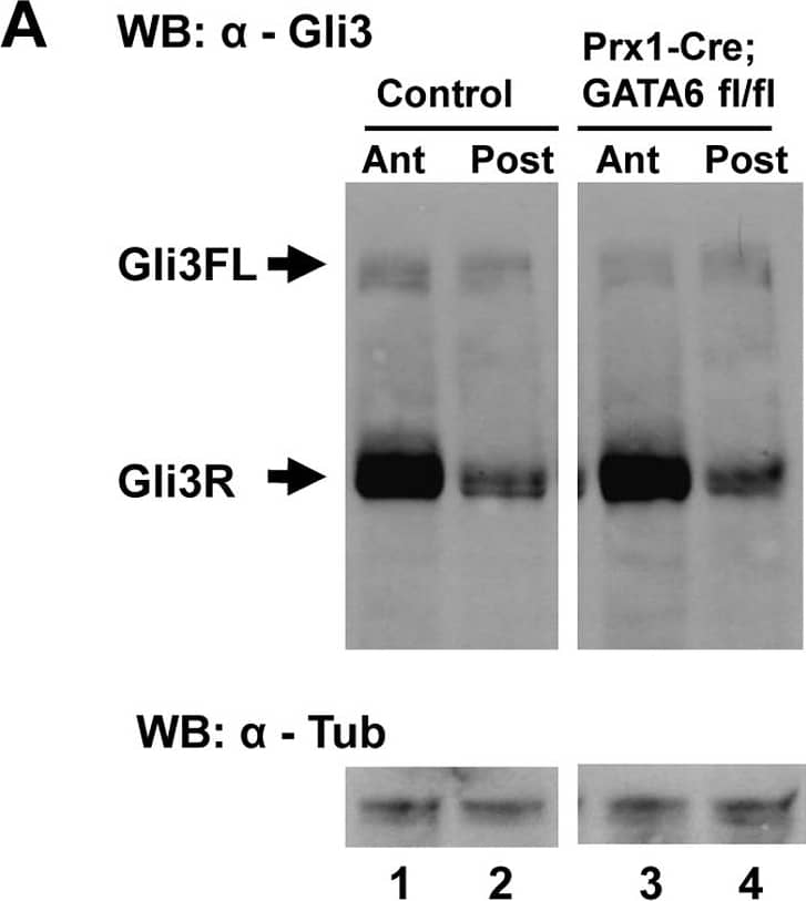 Detection of Mouse GLI-3 by Western Blot