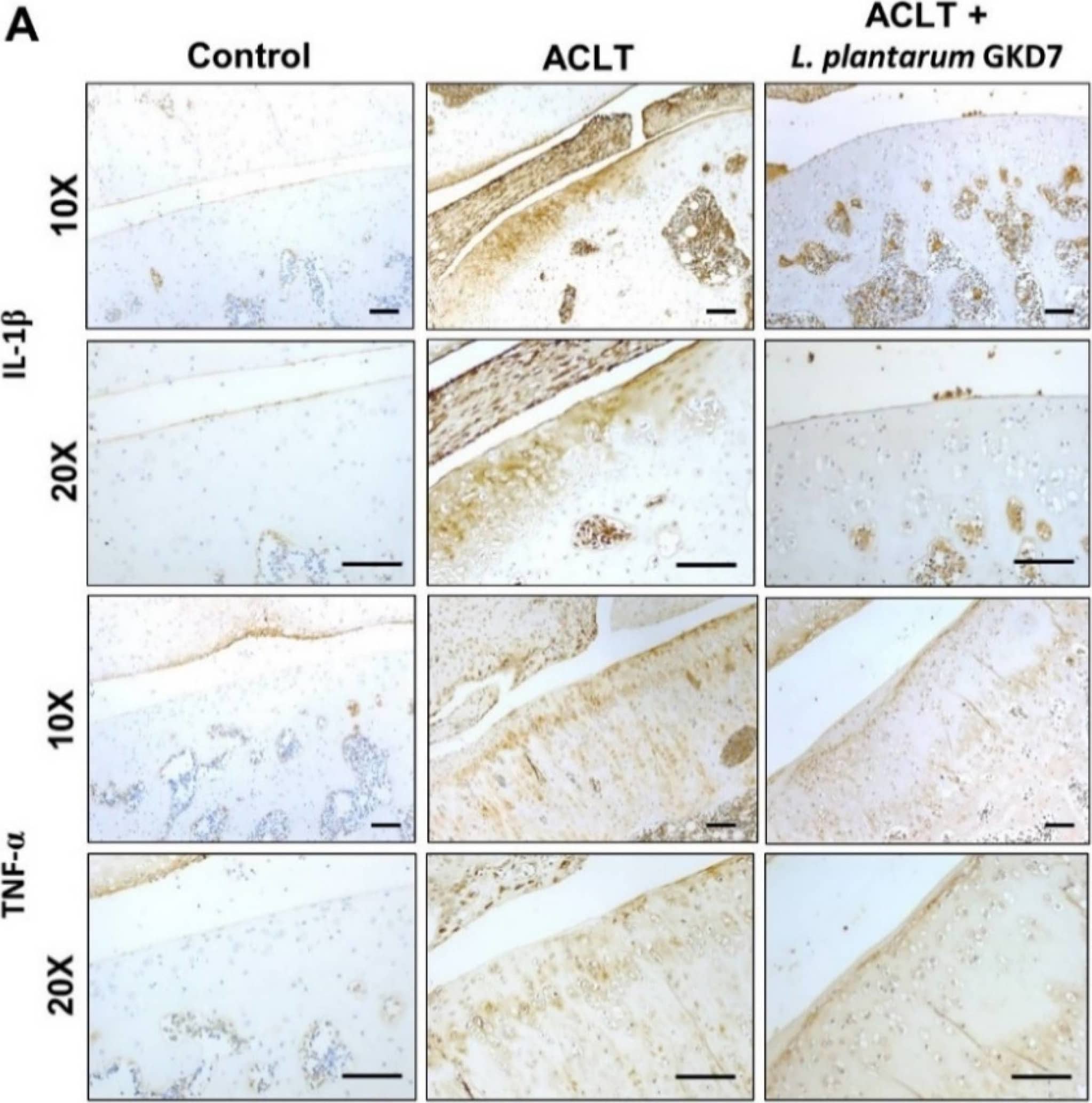 Detection of IL-1 beta/IL-1F2 by Immunohistochemistry