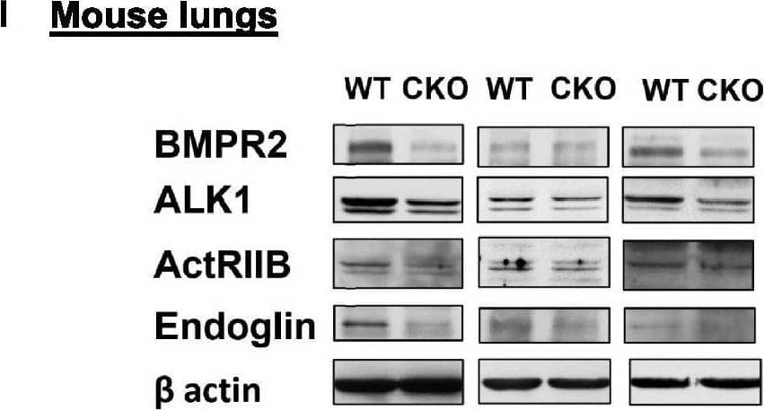 Detection of Mouse ALK-1 by Western Blot