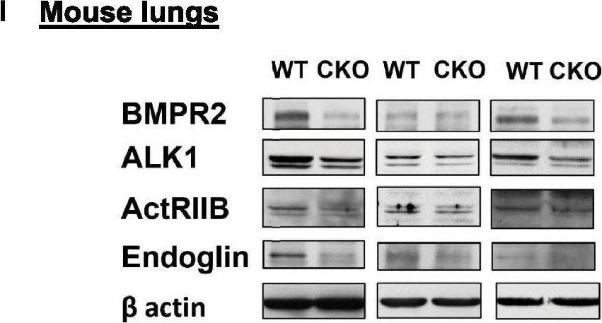Detection of Mouse ALK-1 by Western Blot