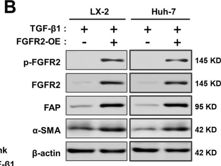 Detection of Fibroblast Activation Protein alpha /FAP by Western Blot