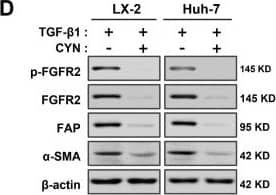 Detection of Fibroblast Activation Protein alpha /FAP by Western Blot