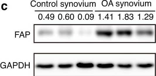 Detection of Fibroblast Activation Protein alpha /FAP by Western Blot