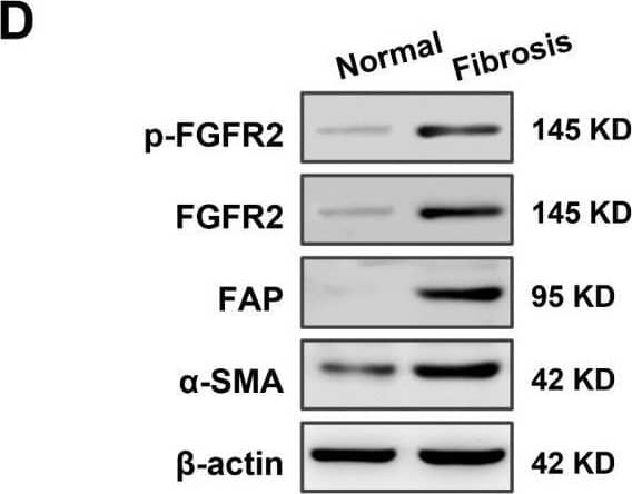 Detection of Fibroblast Activation Protein alpha /FAP by Western Blot