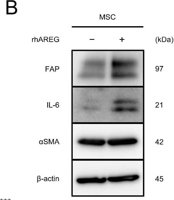 Detection of Fibroblast Activation Protein alpha /FAP by Western Blot