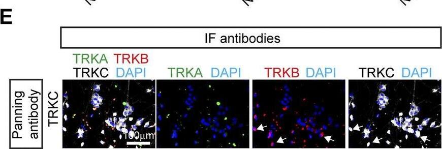 Detection of TrkC by Immunohistochemistry