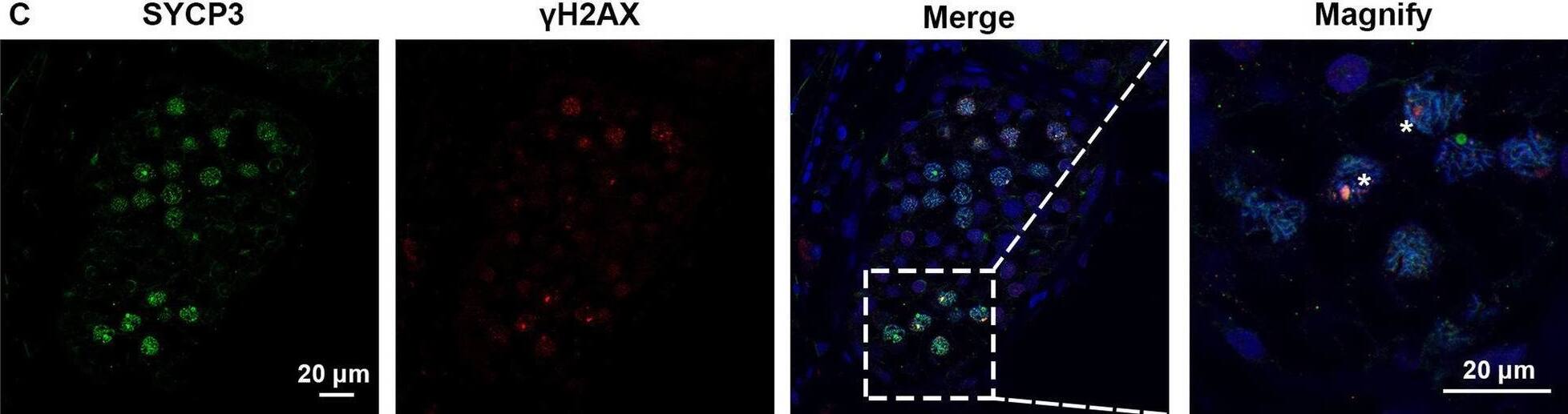Detection of SCP3/SYCP3 by Immunohistochemistry