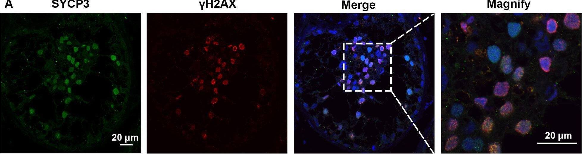 Detection of SCP3/SYCP3 by Immunohistochemistry