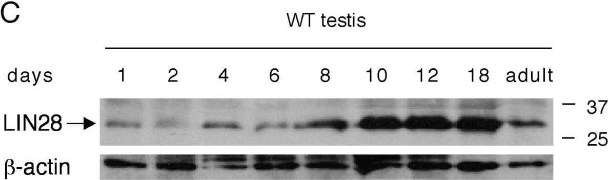 Detection of LIN-28A by Western Blot