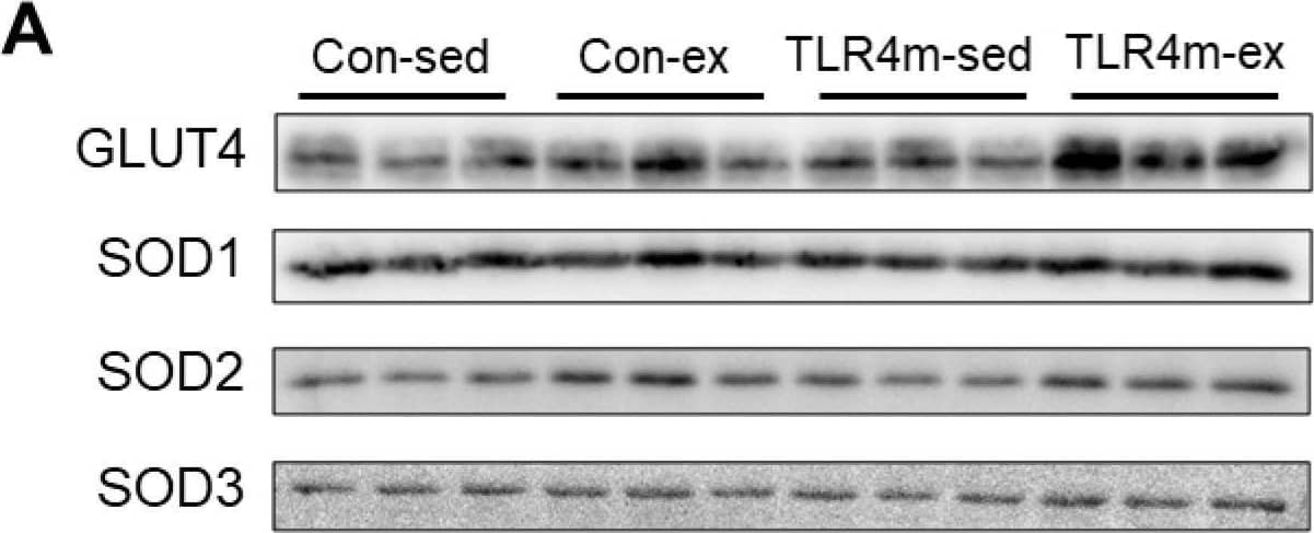 Detection of SOD1/Cu-Zn SOD by Western Blot