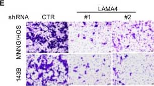 Detection of Laminin alpha 4 by Immunohistochemistry