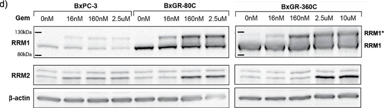 Detection of p53R2 by Western Blot