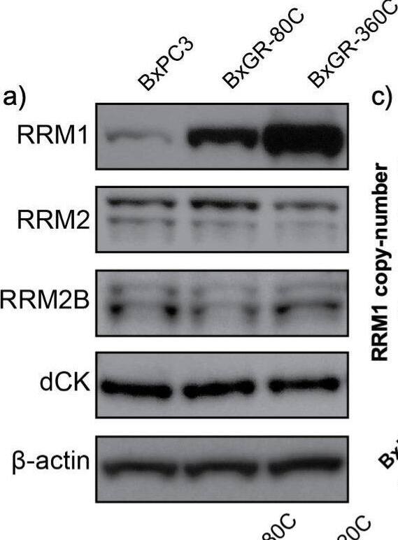 Detection of p53R2 by Western Blot