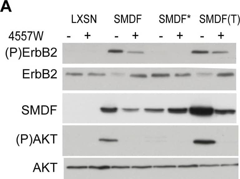 Detection of Neuregulin-1 Isoform SMDF by Western Blot