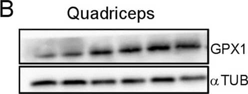 Detection of Mouse Glutathione Peroxidase 1/GPX1 by Western Blot