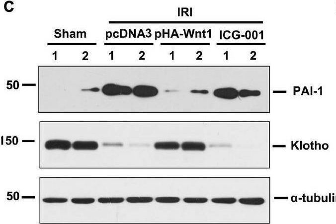 Detection of Serpin E1/PAI-1 by Western Blot