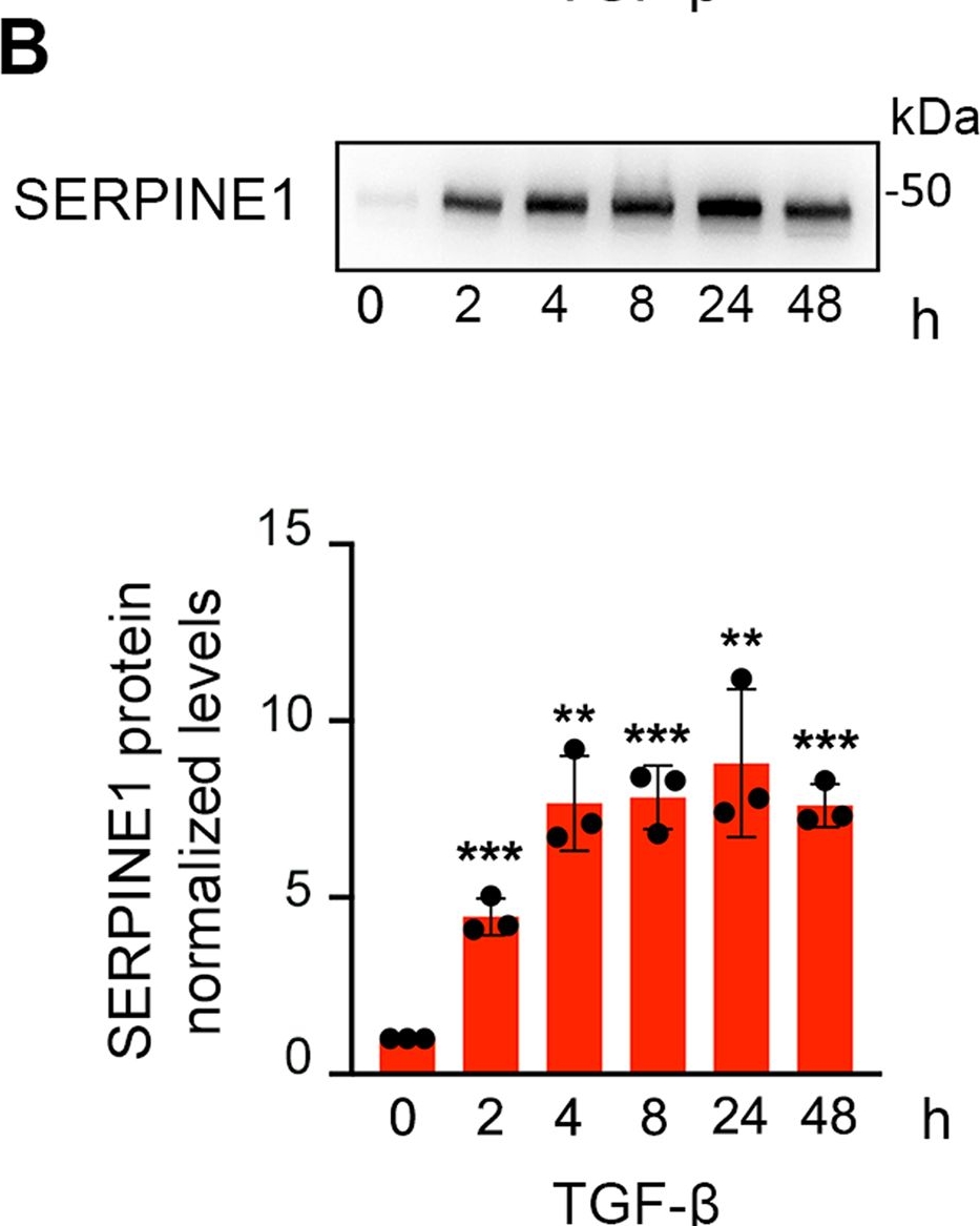Detection of Mouse Serpin E1/PAI-1 by Western Blot
