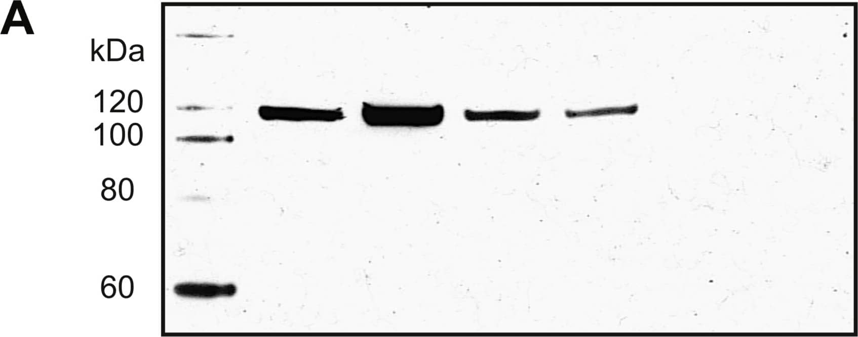 Detection of Human Aminopeptidase LRAP/ERAP2 by Western Blot