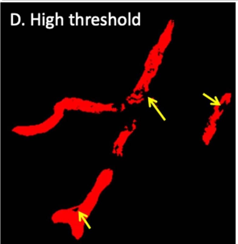 Detection of Mouse Laminin alpha 4 by Immunohistochemistry